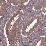 GNPDA2 Antibody in Immunohistochemistry (Paraffin) (IHC (P))