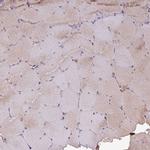 GNPDA2 Antibody in Immunohistochemistry (Paraffin) (IHC (P))