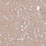 FAM89B Antibody in Immunohistochemistry (Paraffin) (IHC (P))