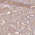 FAM89B Antibody in Immunohistochemistry (Paraffin) (IHC (P))