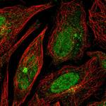 RPP25 Antibody in Immunocytochemistry (ICC/IF)