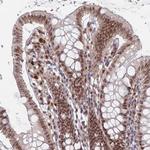 RPP25 Antibody in Immunohistochemistry (Paraffin) (IHC (P))