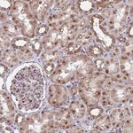 RPP25 Antibody in Immunohistochemistry (Paraffin) (IHC (P))