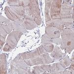 RPP25 Antibody in Immunohistochemistry (Paraffin) (IHC (P))