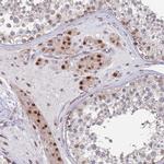 RPP25 Antibody in Immunohistochemistry (Paraffin) (IHC (P))