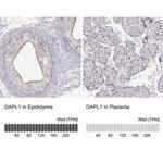 DAPL1 Antibody in Immunohistochemistry (IHC)