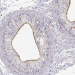 DAPL1 Antibody in Immunohistochemistry (IHC)