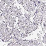 DAPL1 Antibody in Immunohistochemistry (IHC)