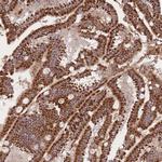 OR10Q1 Antibody in Immunohistochemistry (Paraffin) (IHC (P))