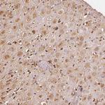 IGFBP-1 Antibody in Immunohistochemistry (Paraffin) (IHC (P))