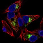 IGFBP-1 Antibody in Immunocytochemistry (ICC/IF)