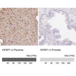 IGFBP-1 Antibody