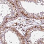 SNAPAP Antibody in Immunohistochemistry (Paraffin) (IHC (P))