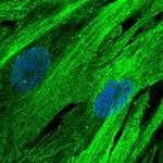 SLC16A4 Antibody in Immunocytochemistry (ICC/IF)