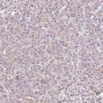 SLC16A4 Antibody in Immunohistochemistry (Paraffin) (IHC (P))