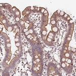 SLC16A4 Antibody in Immunohistochemistry (Paraffin) (IHC (P))