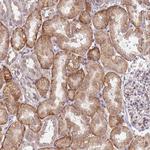 SLC16A4 Antibody in Immunohistochemistry (IHC)