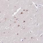 Arp3 Antibody in Immunohistochemistry (Paraffin) (IHC (P))