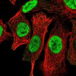 SLX1A Antibody in Immunocytochemistry (ICC/IF)