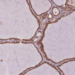 SLX1A Antibody in Immunohistochemistry (IHC)