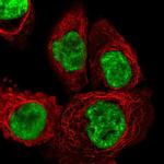 DHX15 Antibody in Immunocytochemistry (ICC/IF)