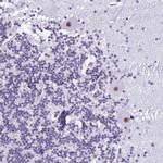 DHX15 Antibody in Immunohistochemistry (IHC)