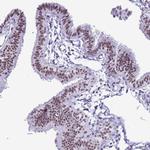 DHX15 Antibody in Immunohistochemistry (IHC)