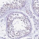 DHX15 Antibody in Immunohistochemistry (IHC)