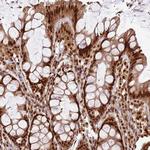 XRN2 Antibody in Immunohistochemistry (Paraffin) (IHC (P))