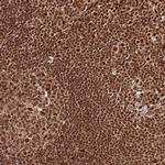 XRN2 Antibody in Immunohistochemistry (Paraffin) (IHC (P))