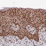 XRN2 Antibody in Immunohistochemistry (Paraffin) (IHC (P))