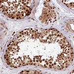 XRN2 Antibody in Immunohistochemistry (Paraffin) (IHC (P))