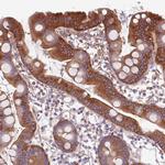 NAALADL1 Antibody in Immunohistochemistry (Paraffin) (IHC (P))