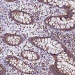 UEVLD Antibody in Immunohistochemistry (Paraffin) (IHC (P))