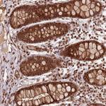 ZBTB12 Antibody in Immunohistochemistry (Paraffin) (IHC (P))