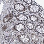 BANP Antibody in Immunohistochemistry (Paraffin) (IHC (P))