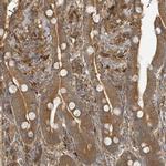 ARPIN Antibody in Immunohistochemistry (IHC)