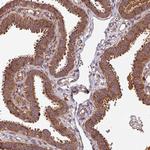 MRRF Antibody in Immunohistochemistry (Paraffin) (IHC (P))