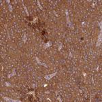 MRRF Antibody in Immunohistochemistry (IHC)