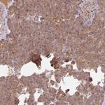 MRRF Antibody in Immunohistochemistry (IHC)