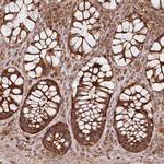 MRRF Antibody in Immunohistochemistry (IHC)