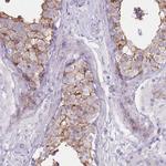 UTP14C Antibody in Immunohistochemistry (Paraffin) (IHC (P))