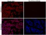 Galectin 9 Antibody in Immunohistochemistry (Paraffin) (IHC (P))