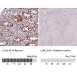 Galectin 9 Antibody in Immunohistochemistry (IHC)