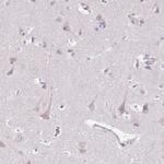 MRPL36 Antibody in Immunohistochemistry (Paraffin) (IHC (P))