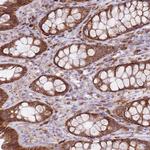 MRPL36 Antibody in Immunohistochemistry (Paraffin) (IHC (P))