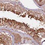 GPR180 Antibody in Immunohistochemistry (Paraffin) (IHC (P))