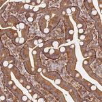 PIH1D1 Antibody in Immunohistochemistry (Paraffin) (IHC (P))