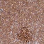 PIH1D1 Antibody in Immunohistochemistry (Paraffin) (IHC (P))