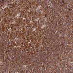 PIH1D1 Antibody in Immunohistochemistry (Paraffin) (IHC (P))